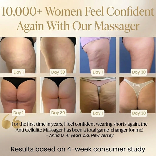 Anti-Cellulite Massager