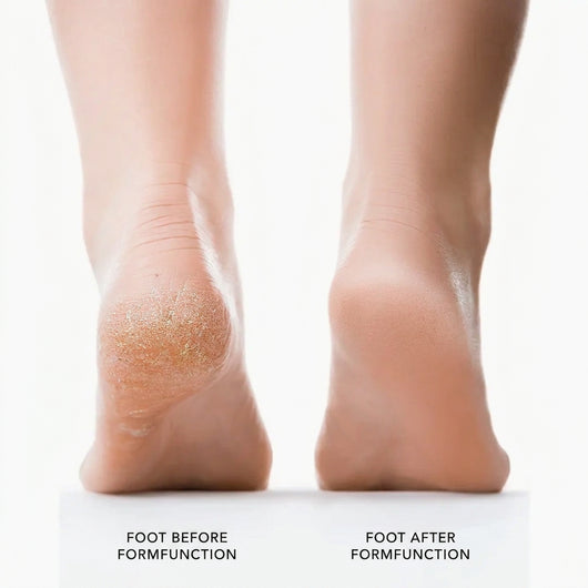 HeelReset3